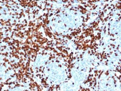 TdT Antibody (DNTT/4506R)