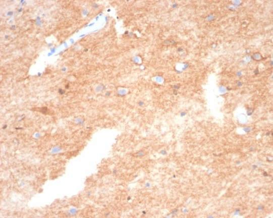 S100P Antibody (S100P/4386R)
