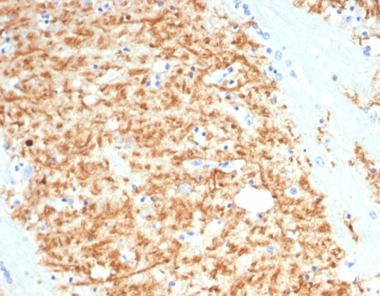 S100P Antibody (S100P/4386R)