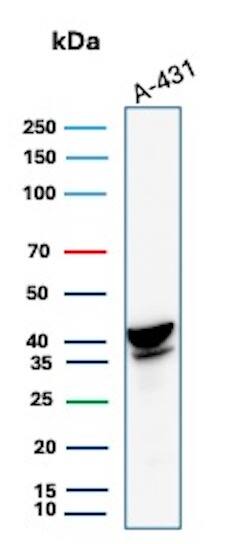 Serpin B3/SCCA1 Antibody (CPTC-SERPINB3-2) Western Blot: Serpin B3/SCCA1 Antibody (CPTC-SERPINB3-2) [NBP3-07785] -