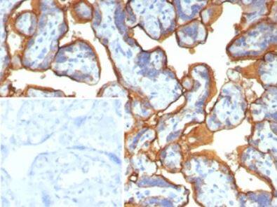 Alkaline Phosphatase/ALPP Antibody (ALPP/2899R)