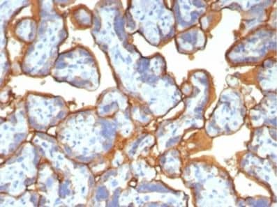 Alkaline Phosphatase/ALPP Antibody (ALPP/2899R)