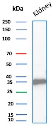 Napsin A Antibody (NAPSA/1865R) Western Blot: Napsin A Antibody (NAPSA/1865R) [NBP3-07870] -