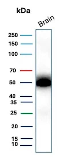 GFAP Antibody (ASTRO/1974R) Western Blot: GFAP Antibody (ASTRO/1974R) [NBP3-07877] -