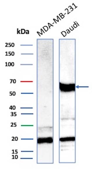 OGG1 Antibody (CPTC-OGG1-1) Western Blot: OGG1 Antibody (CPTC-OGG1-1) [NBP3-07886] -