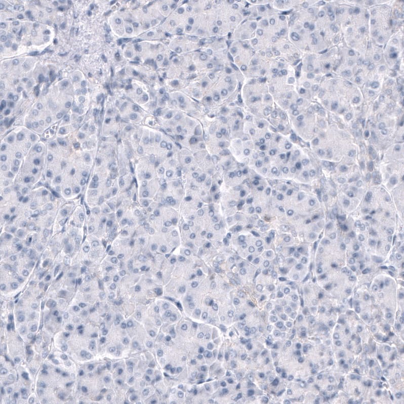 TRPM4 Antibody (CL11214) - BSA Free Immunohistochemistry-Paraffin: TRPM4 Antibody (CL11214) [NBP3-07990]