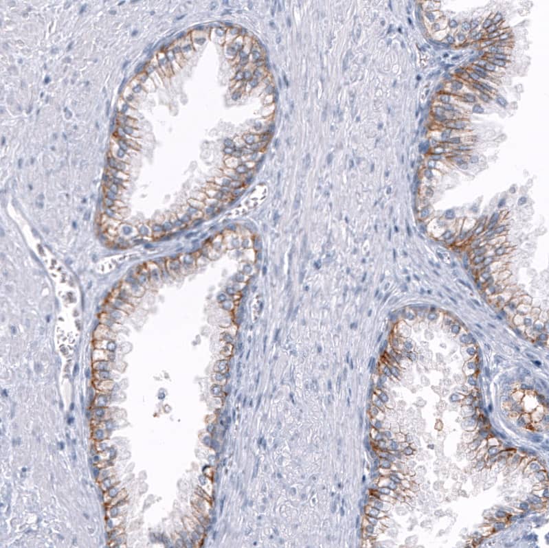 TRPM4 Antibody (CL11214) - BSA Free Immunohistochemistry-Paraffin: TRPM4 Antibody (CL11214) [NBP3-07990]