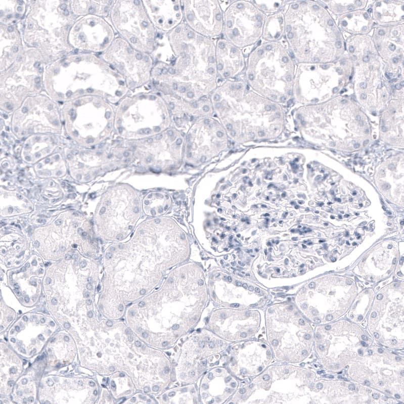 GPR17 Antibody (CL10474) - BSA Free Immunohistochemistry-Paraffin: GPR17 Antibody (CL10474) [NBP3-07993]
