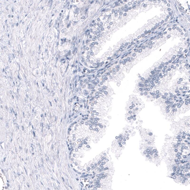 GPR17 Antibody (CL10474) - BSA Free Immunohistochemistry-Paraffin: GPR17 Antibody (CL10474) [NBP3-07993]