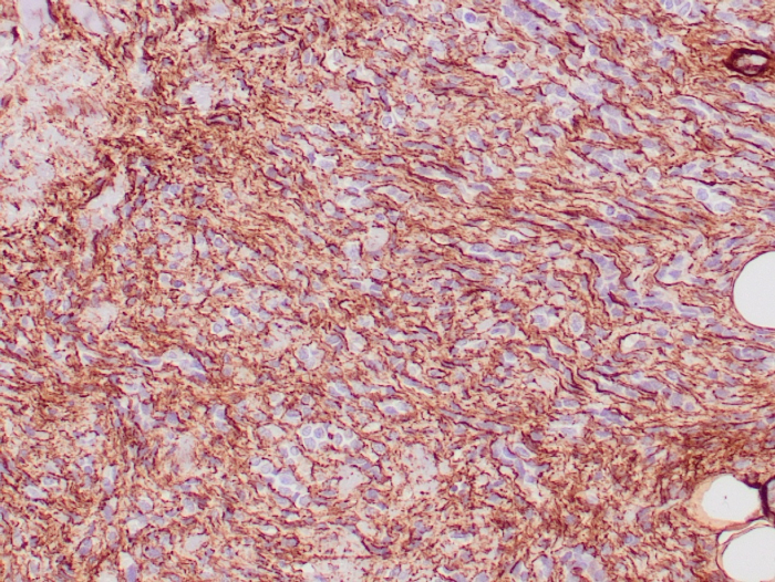 Collagen IV Antibody (COL4/4241R) - Azide and BSA Free