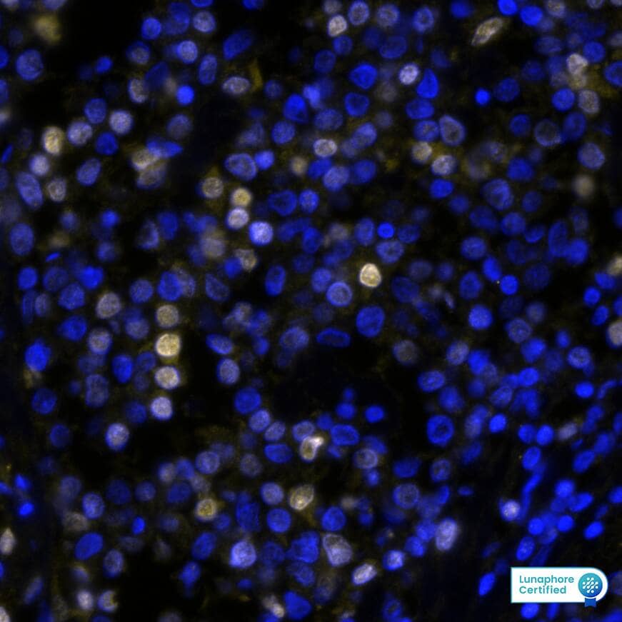 IRF4 Antibody (MUM1/8274R) - BSA Free IRF4 Antibody (MUM1/8274R) IRF4 in Human Hodgkin�s Lymphoma via seqIF� staining on COMET�