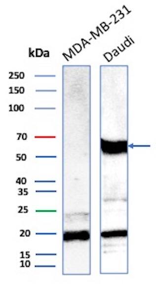 OGG1 Antibody (CPTC-OGG1-1) - Azide and BSA Free Western Blot: OGG1 Antibody (CPTC-OGG1-1) - Azide and BSA Free [NBP3-08481] -