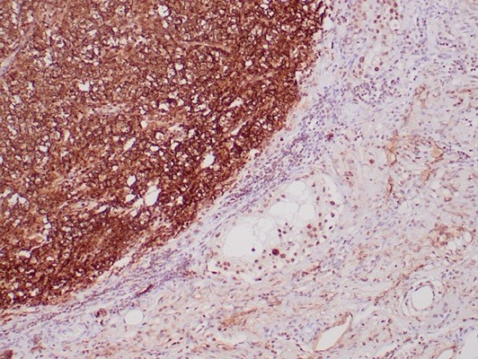 Podoplanin Antibody (PDPN/4009R) - Azide and BSA Free