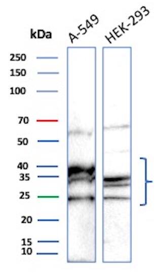 UBE2R1/CDC34 Antibody (CPTC-CDC34-2) - Azide and BSA Free Western Blot: UBE2R1/CDC34 Antibody (CPTC-CDC34-2) - Azide and BSA Free [NBP3-08839] -