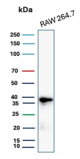 Cyclin D1 Antibody (rCCND1/4752) - Azide and BSA Free Western Blot: Cyclin D1 Antibody (rCCND1/4752) - Azide and BSA Free [NBP3-08953] -