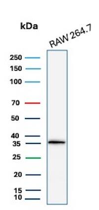 Cyclin D1 Antibody (CCND1/3370R) - Azide and BSA Free Western Blot: Cyclin D1 Antibody (CCND1/3370R) - Azide and BSA Free [NBP3-08955] -