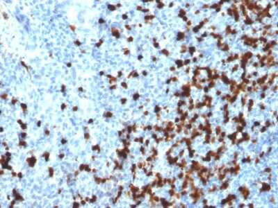 TCL1A Antibody (TCL1/2079) - Azide and BSA Free Immunohistochemistry-Paraffin: TCL1A Antibody (TCL1/2079) - Azide and BSA Free [NBP3-11312] -