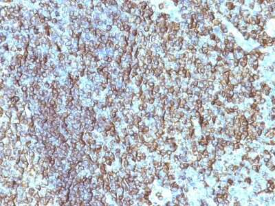 HLA DRB1 Antibody (SPM288) - Azide and BSA Free Immunohistochemistry-Paraffin: HLA DRB1 Antibody (SPM288) - Azide and BSA Free [NBP3-11419] -