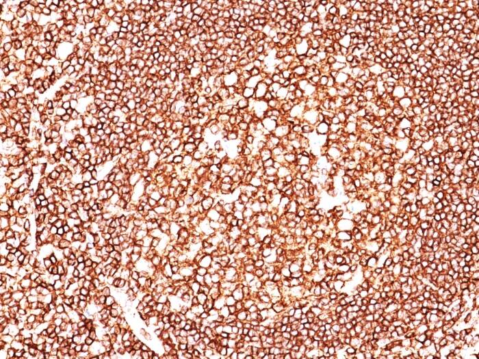 CD45 Antibody (135-4C5) - Azide and BSA Free Immunohistochemistry-Paraffin: CD45 Antibody (135-4C5) - Azide and BSA Free [NBP3-11434] -