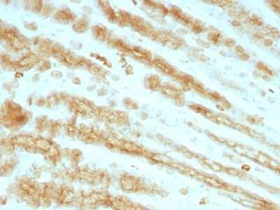 Cytokeratin, pan Antibody (KRTL/1077 + KRTH/1076) - Azide and BSA Free Immunohistochemistry-Paraffin: Cytokeratin, pan Antibody (KRTL/1077 + KRTH/1076) - Azide and BSA Free [NBP3-11443] -