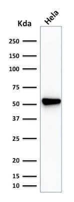 Fascin Antibody (SPM133) - Azide and BSA Free Western Blot: Fascin Antibody (SPM133) - Azide and BSA Free [NBP3-11444] -