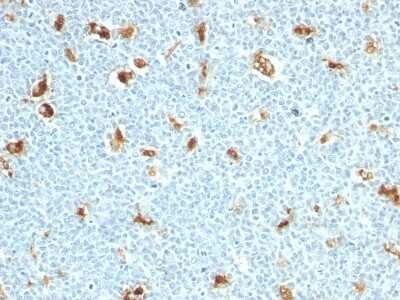 S100A9 Antibody (S100A9/1011) - Azide and BSA Free Immunohistochemistry-Paraffin: S100A9 Antibody (S100A9/1011) - Azide and BSA Free [NBP3-11453] -