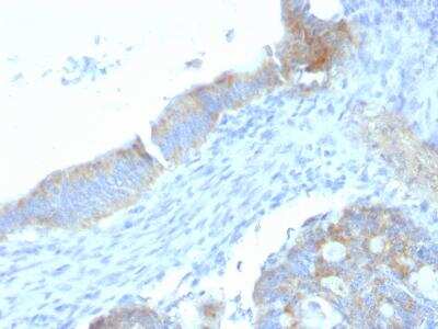 Endorepellin/Perlecan/Heparan Sulfate Proteoglycan Antibody (SPM255) - Azide and BSA Free Immunohistochemistry-Paraffin: Endorepellin/Perlecan/Heparan Sulfate Proteoglycan Antibody (SPM255) - Azide and BSA Free [NBP3-11461] -