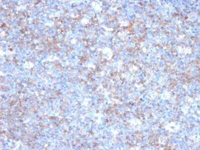 MCAM/CD146 Antibody (C146/634) - Azide and BSA Free Immunohistochemistry-Paraffin: MCAM/CD146 Antibody (C146/634) - Azide and BSA Free [NBP3-11467] -