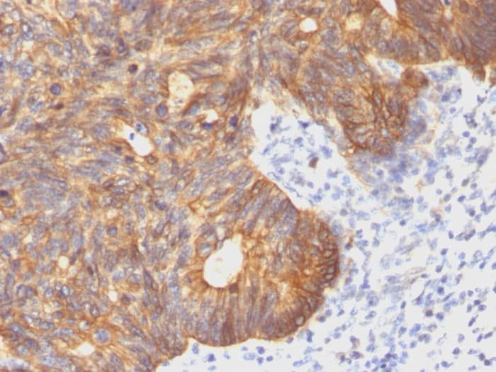 Cytokeratin 8 Antibody (C-43) - Azide and BSA Free Immunohistochemistry-Paraffin: Cytokeratin 8 Antibody (C-43) - Azide and BSA Free [NBP3-11481] -