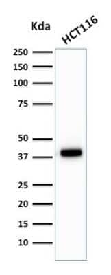 Cytokeratin 18 Antibody (C-04 (same as Ks18.04)) - Azide and BSA Free Western Blot: Cytokeratin 18 Antibody (C-04 (same as Ks18.04)) - Azide and BSA Free [NBP3-11485] -