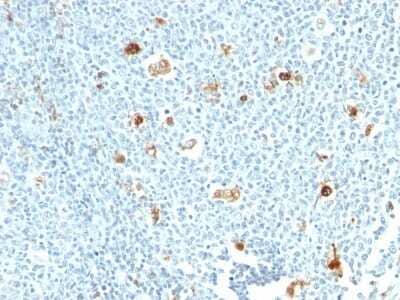 S100A9 Antibody (CPT/1028) - Azide and BSA Free Immunohistochemistry-Paraffin: S100A9 Antibody (CPT/1028) - Azide and BSA Free [NBP3-11501] -