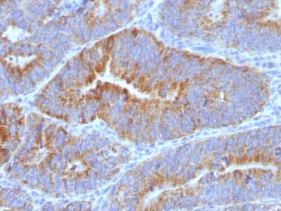 Thomsen-Friedenreich Antigen Antibody (SPM320) - Azide and BSA Free Immunohistochemistry-Paraffin: Thomsen-Friedenreich Antigen Antibody (SPM320) - Azide and BSA Free [NBP3-11524] -