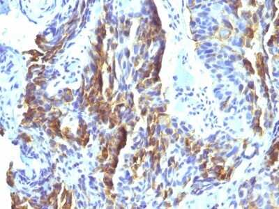 Melanoma Associated Antigen (KBA.62) Antibody (KBA.62) - Azide and BSA Free Immunohistochemistry-Paraffin: Melanoma Associated Antigen (KBA.62) Antibody (KBA.62) - Azide and BSA Free [NBP3-11535] -