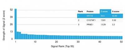 Cytokeratin 18 Antibody (KRT18/836) - Azide and BSA Free Protein Array: Cytokeratin 18 Antibody (KRT18/836) - Azide and BSA Free [NBP3-11544] -