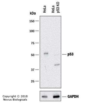 p53 Antibody (TRP/817) - Azide and BSA Free Western Blot: p53 Antibody (TRP/817) - Azide and BSA Free [NBP3-11546] -