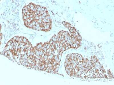 S100A9 Antibody (S100A9/1075) - Azide and BSA Free Immunohistochemistry-Paraffin: S100A9 Antibody (S100A9/1075) - Azide and BSA Free [NBP3-11559] -