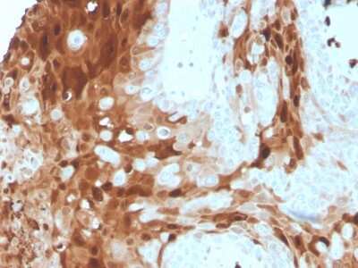 S100A9 Antibody (S100A9/1075) - Azide and BSA Free Immunohistochemistry-Paraffin: S100A9 Antibody (S100A9/1075) - Azide and BSA Free [NBP3-11559] -
