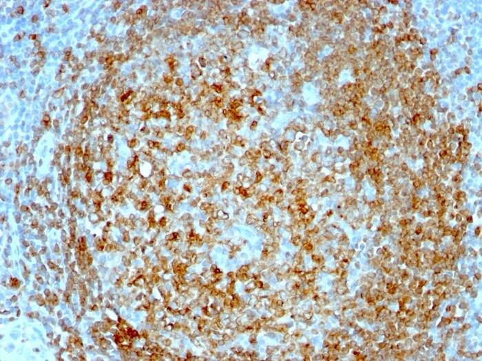CD74 Antibody (CLIP/813) - Azide and BSA Free Immunohistochemistry-Paraffin: CD74 Antibody (CLIP/813) - Azide and BSA Free [NBP3-11568] -