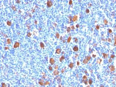 Fascin Antibody (FSCN1/416) - Azide and BSA Free Immunohistochemistry-Paraffin: Fascin Antibody (FSCN1/416) - Azide and BSA Free [NBP3-11582] -
