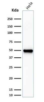 Fascin Antibody (FSCN1/416) - Azide and BSA Free Western Blot: Fascin Antibody (FSCN1/416) - Azide and BSA Free [NBP3-11582] -