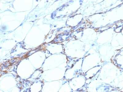 Myosin heavy chain 11 Antibody (SPM201) - Azide and BSA Free Immunohistochemistry-Paraffin: Myosin heavy chain 11 Antibody (SPM201) - Azide and BSA Free [NBP3-11585] -
