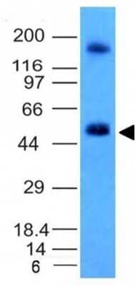 Carbonic Anhydrase IX/CA9 Antibody (CA9/781) - Azide and BSA Free Western Blot: Carbonic Anhydrase IX/CA9 Antibody (CA9/781) - Azide and BSA Free [NBP3-11591] -