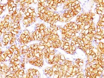 Carbonic Anhydrase IX/CA9 Antibody (PN-15) - Azide and BSA Free Immunohistochemistry-Paraffin: Carbonic Anhydrase IX/CA9 Antibody (PN-15) - Azide and BSA Free [NBP3-11592] -