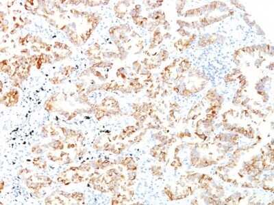 Cytokeratin 7 Antibody (SPM270) - Azide and BSA Free Immunohistochemistry-Paraffin: Cytokeratin 7 Antibody (SPM270) - Azide and BSA Free [NBP3-11594] -