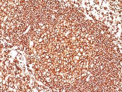 CD45 Antibody (136-4B5) - Azide and BSA Free Immunohistochemistry-Paraffin: CD45 Antibody (136-4B5) - Azide and BSA Free [NBP3-11595] -