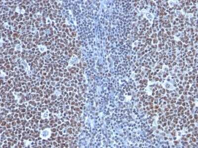 Cyclin B1 Antibody (SPM619) - Azide and BSA Free Immunohistochemistry-Paraffin: Cyclin B1 Antibody (SPM619) - Azide and BSA Free [NBP3-11598] -