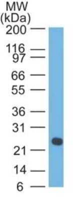 Lambda Light Chain Antibody (LcN-2) - Azide and BSA Free Western Blot: Lambda Light Chain Antibody (LcN-2) - Azide and BSA Free [NBP3-11602] -