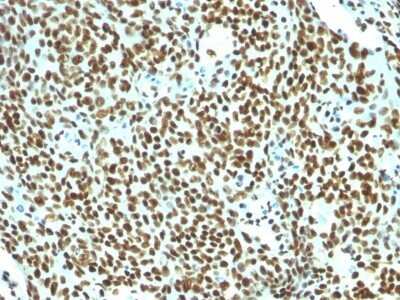 Nuclear Antigen Antibody (NM106) - Azide and BSA Free Immunohistochemistry-Paraffin: Nuclear Antigen Antibody (NM106) - Azide and BSA Free [NBP3-11613] -