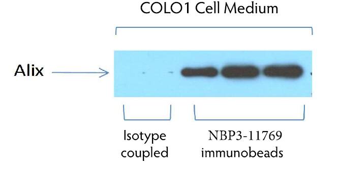 CD63 Immunobeads for Exosome Isolation