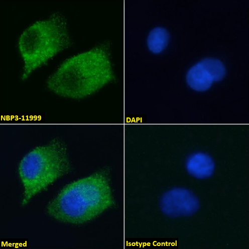 AGER Antibody (2A11) - Chimeric - Azide and BSA Free